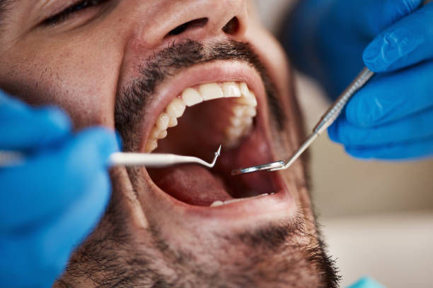 Best Chipped Tooth Repair Near Me  in Alturas, FL